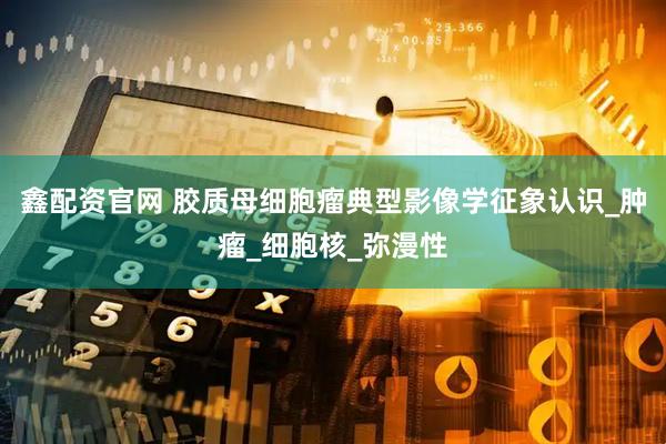 鑫配资官网 胶质母细胞瘤典型影像学征象认识_肿瘤_细胞核_弥漫性